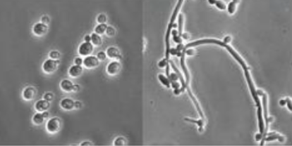 You inoculate a pure culture onto a petri dish, but when you look at the culture after it has grown, you find both of the organisms shown. What is the best explanation for this?