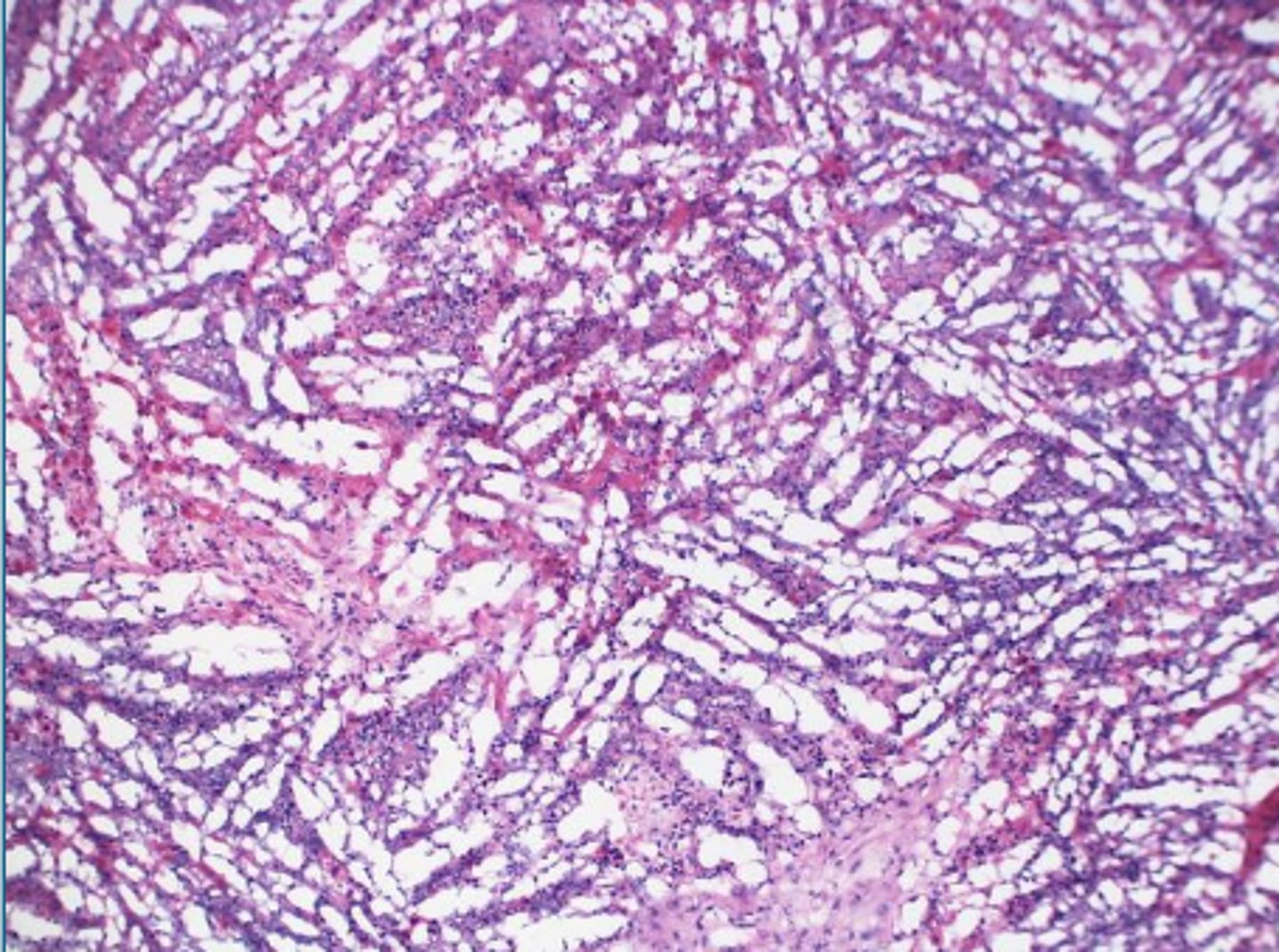 <p>What histological artifact?</p>