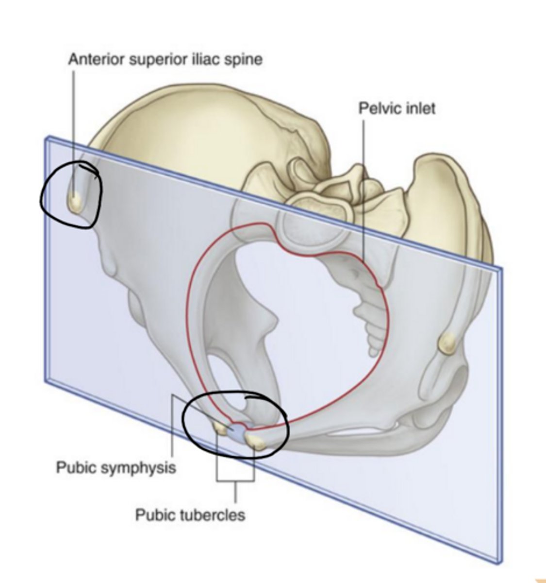 <p>anterior superior iliac spine</p>