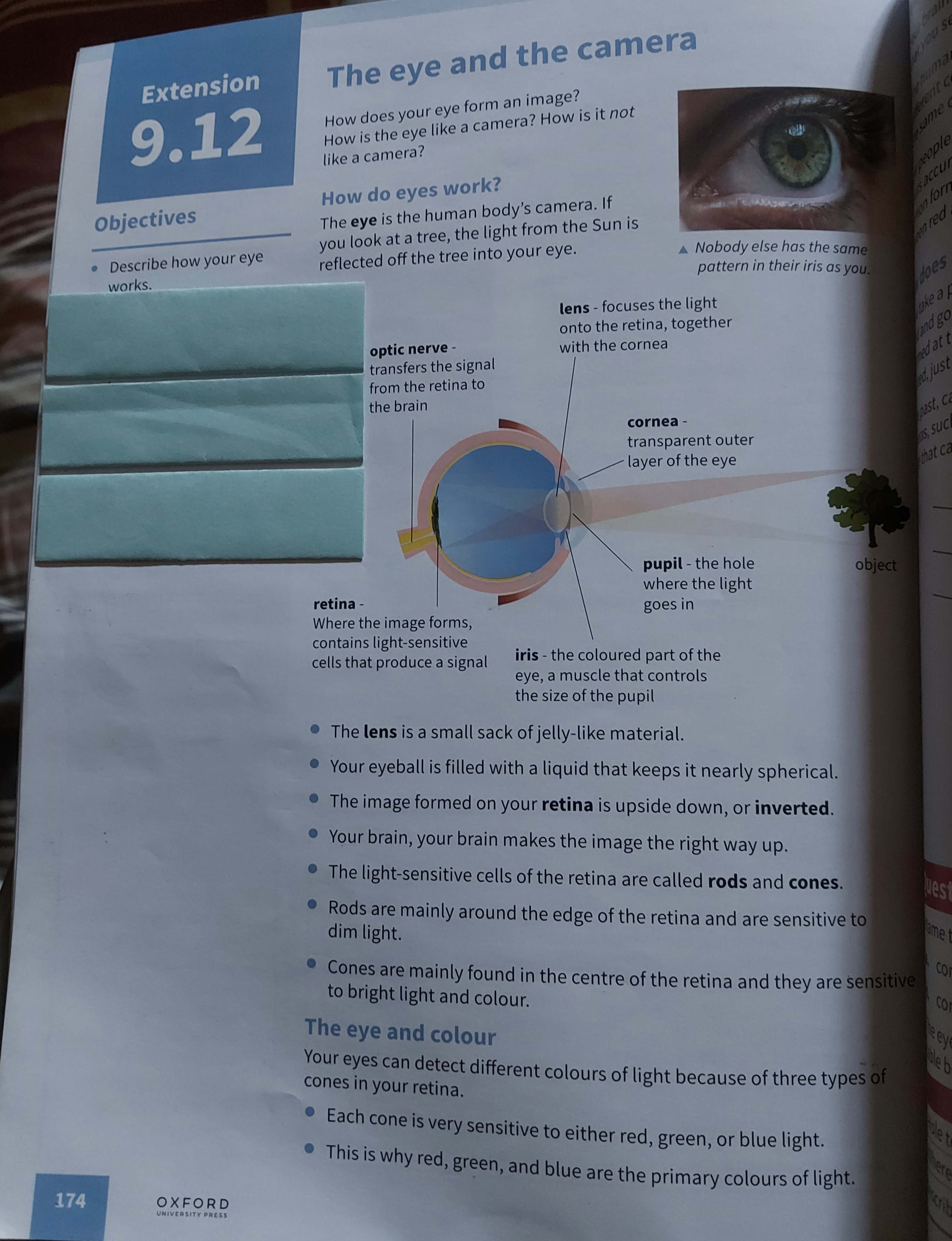 <p>Structure of the eye</p>