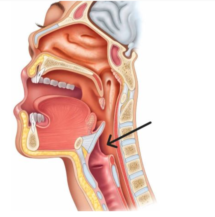 <p>The highlighted structure is: </p>