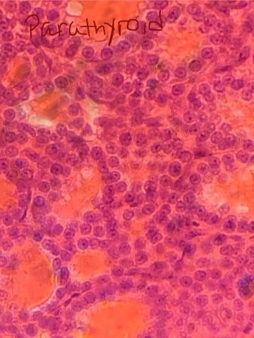 <p>Identify this slide.</p>