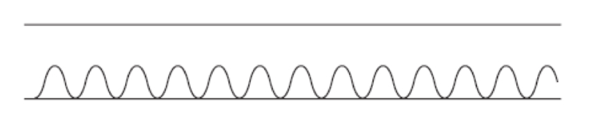 <p>Welke ademhaing zie je hier</p>