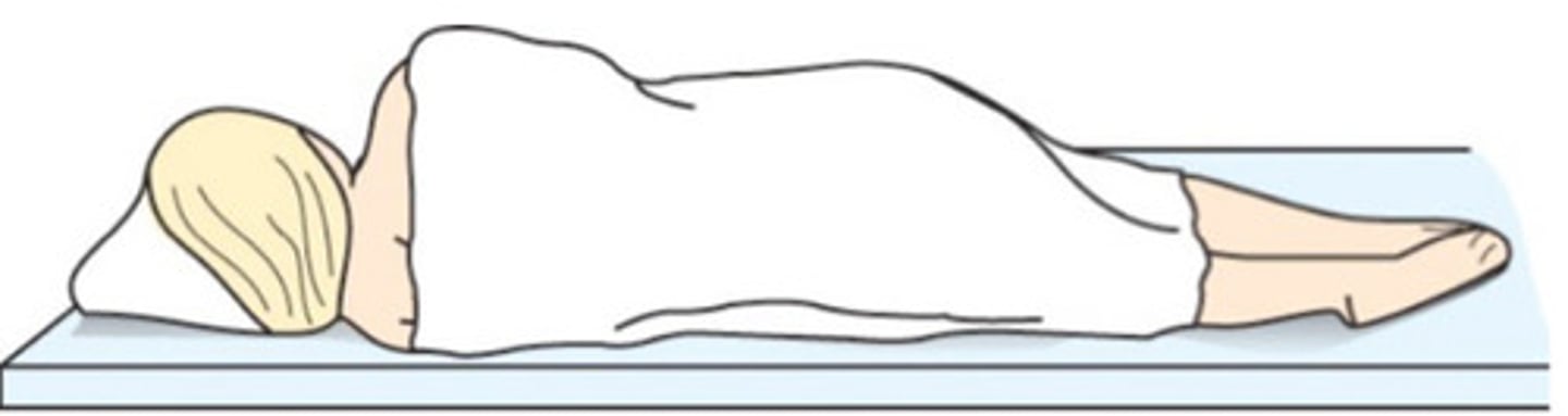 <p>lying on either the left or right side</p>