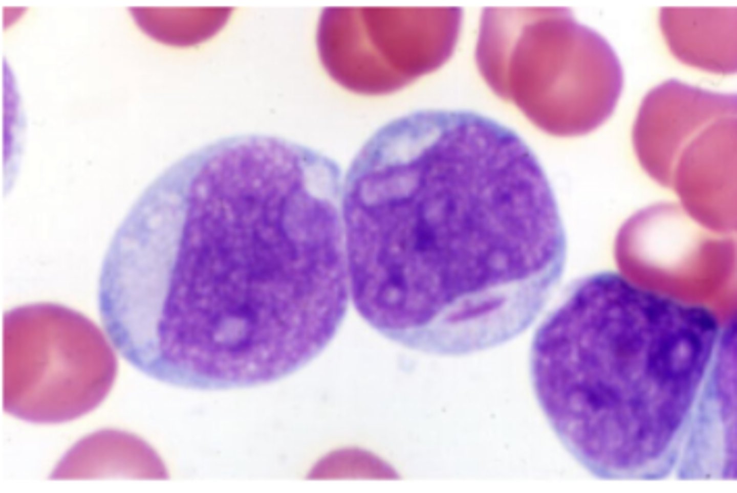 <p>round or oval, with delicate, lacy, evenly stained chromatin and 1–5 visible nucleoli.</p>