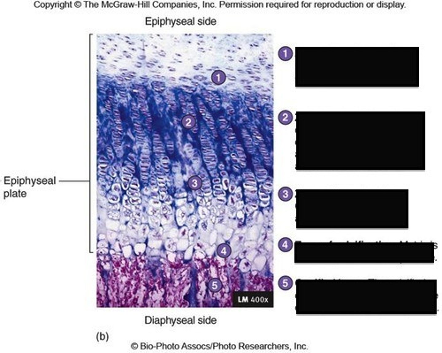 <p>zone where older chondrocytes closer to diaphysis and their lacunae enlarge and erode interconnecting spaces</p>