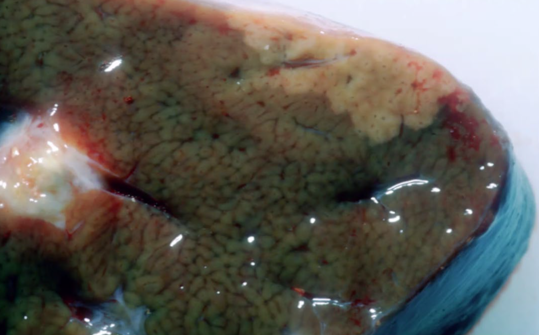 <p>What is the condition?</p><p>A-Bacillary hemoglobinuria</p><p>B-Necrobacillosis</p><p>C-Tension lipidosis</p><p>D-lnfectious necrotic hepatitis</p>