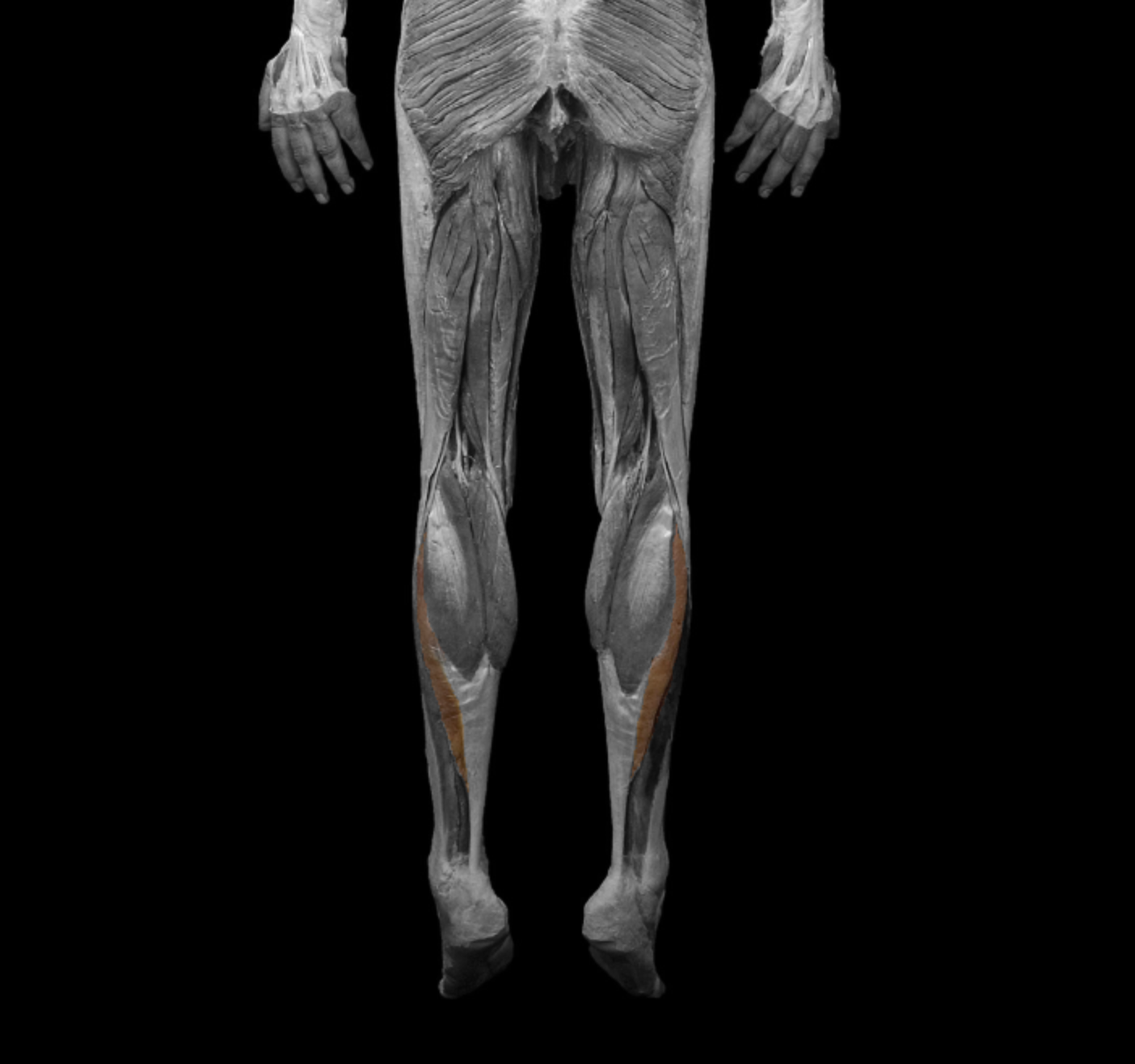 <p>origin: head of fibula, medial border of tibia</p><p></p><p>insertion: calcaneus (achilles) </p><p></p><p>action: plantar flex </p><p></p><p>innervation: tibial nerve </p>