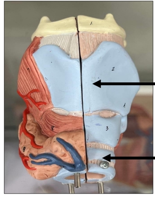 <p>identify from up to down</p><p>where does the tube at the bottom begin ?</p><p>where does the tube at the bottom terminate</p>