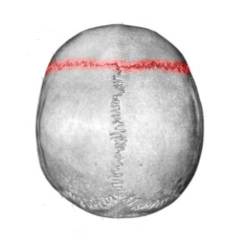 <p>Which cranial suture is this? (1)</p>