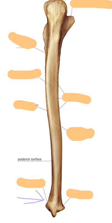 <p>like a nub, not pointy like styloid process; distal</p>