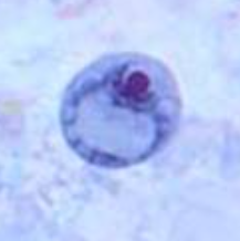 <p>Identify this organism and stage</p>
