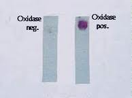 <p>-take a colony of bacteria -scrape it onto a small piece of filter paper -add a drop of oxidase reagent</p>