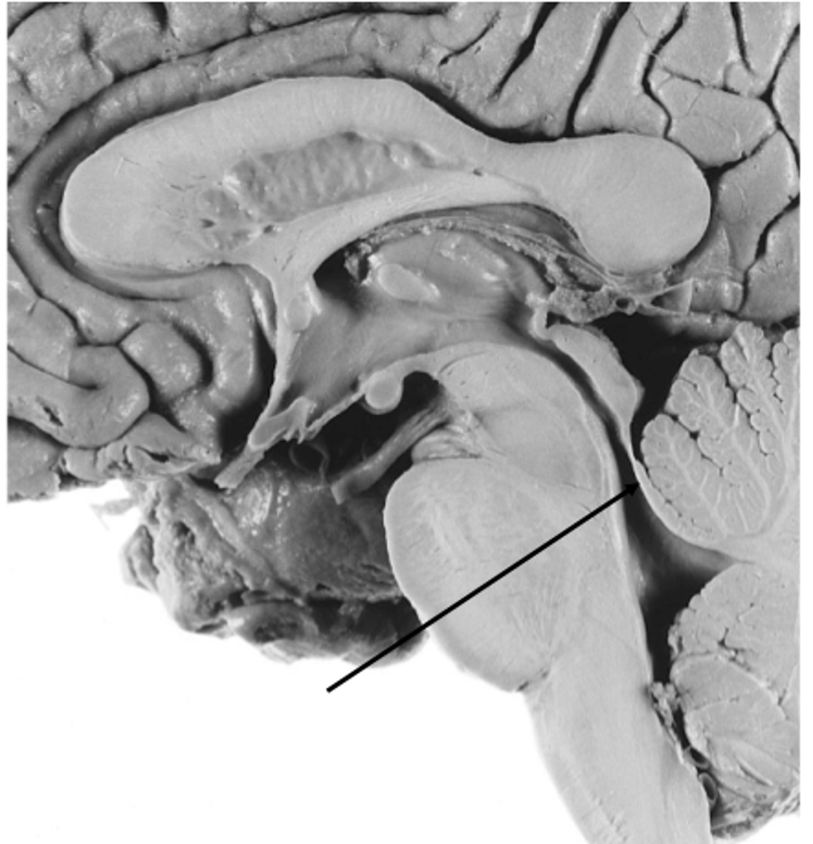 <p>superior medullary velum</p>