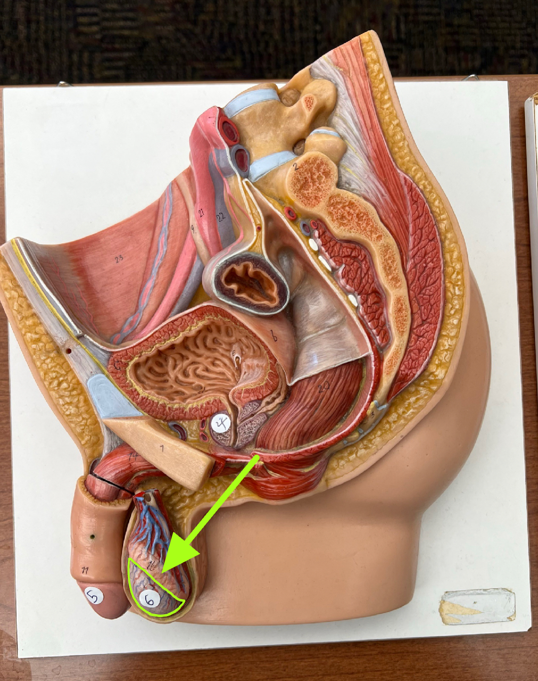 identify this organ