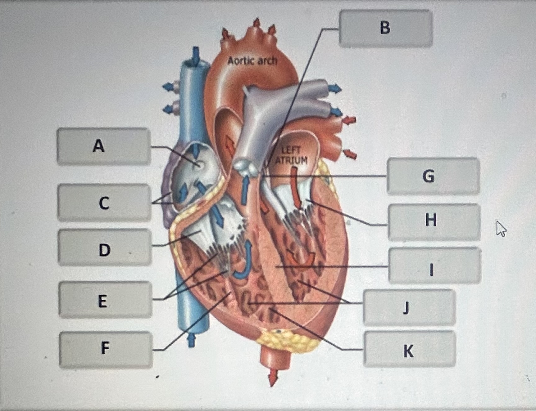 Identify the anatomical feature of the frontal section of the heart labeled D