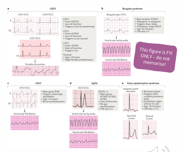 <p>Cardiac Arrhythmia</p>