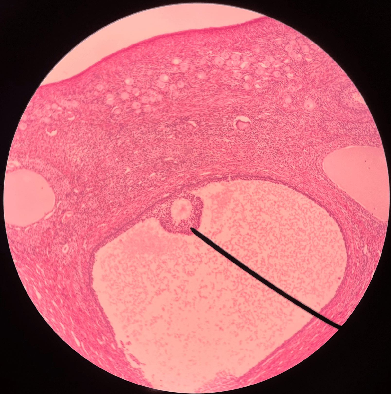 • Slide histology of the ovary.

• The layers of cells surrounding the oocyte and separating it from the antrum.