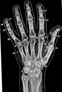 <p>Os pisiforme </p>
