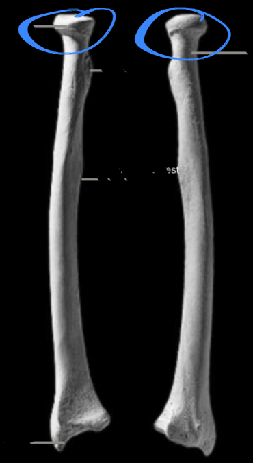 <p>Articulated with the humerus, located on the radius </p>