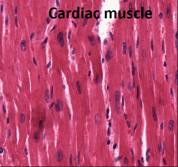 <p>This tissue is found only in heart</p><p>Makes up bulk of heart walls</p><p>Striated</p><p>Involuntary: cannot be controlled consciously</p><p>Contracts at steady rate due to heart’s own pacemaker, but nervous system can increase rate</p><p>Key words for cardiac muscle: cardiac, striated, and involuntary</p>