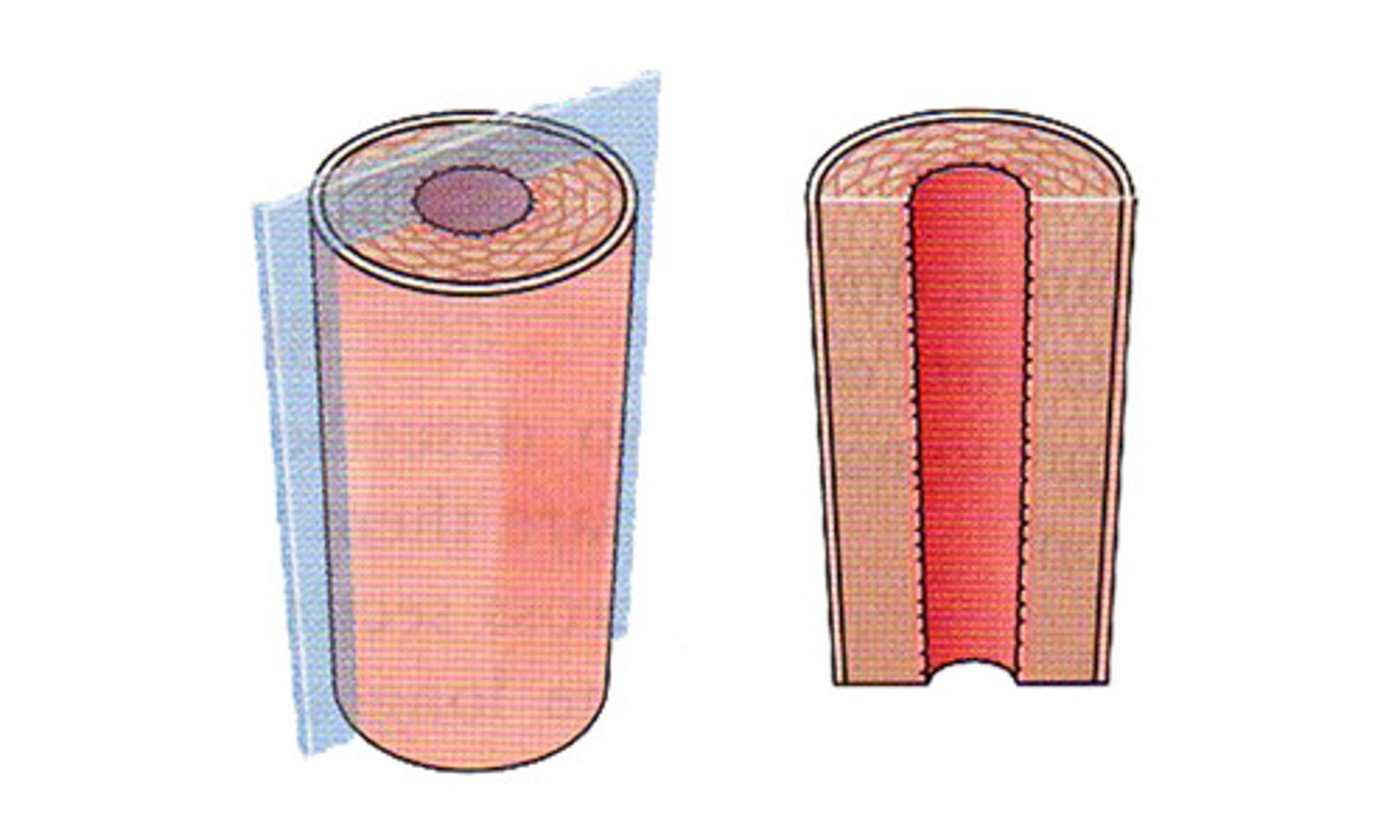 <p>Cut along the length of an organ</p>
