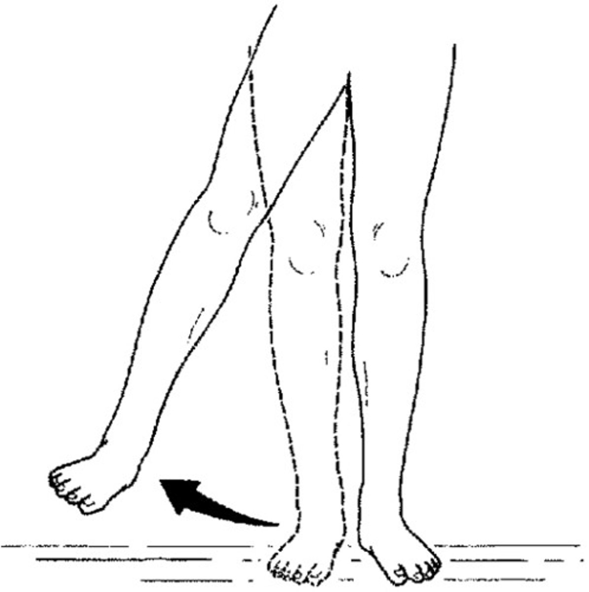 <p>moving away from median plane</p>