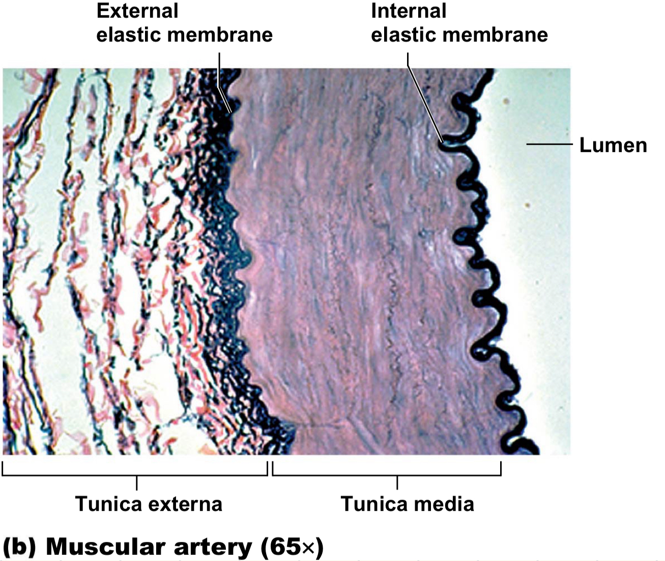 <ul><li><p>aka distributing <u>because take from elastic arteries → body</u></p></li><li><p>THICK tunica media</p></li><li><p>in/external elastic membrane</p></li><li><p>“muscle” so contract = increase pressure and dilate = decrease pressure</p></li></ul>