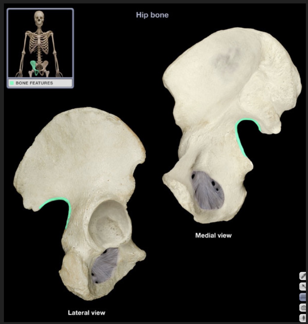 <p><span style="font-family: Arial, sans-serif; color: rgb(45, 59, 69)">posterior indentation in ilium</span></p>
