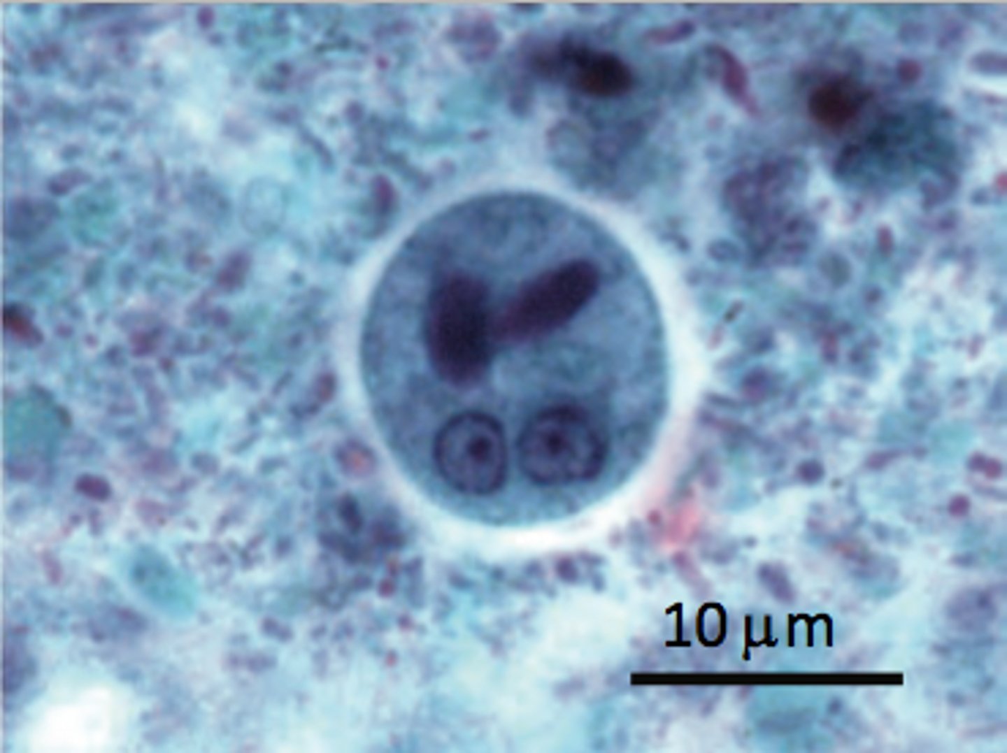 <p>up to 4 nuclei, blunted chromatid bodies</p>