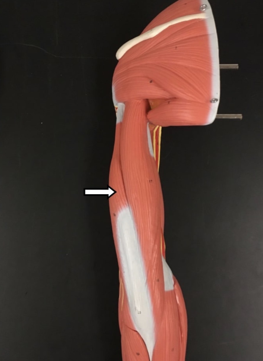 <p><span>Name the muscle labeled with the white arrow below - be specific! - AND name the insertion</span></p>