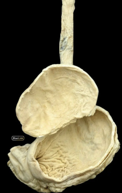 <p>acidic paste of stomach</p><ul><li><p>mechanical mixing of food and production of ______</p></li><li><p>initiates major protein digestion</p></li><li><p>storage of _____ until it passes into the duodenum</p></li><li><p>minimal absorption (e.g. some drugs, alcohol)</p></li></ul><p></p>