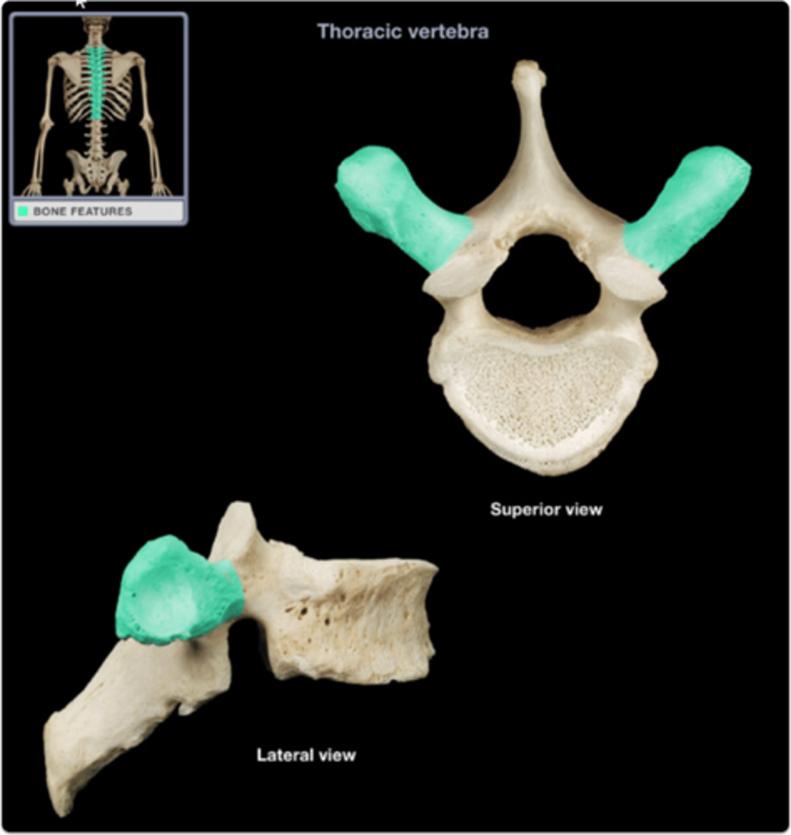 <p>two lateral projections from the vertebral arch</p>