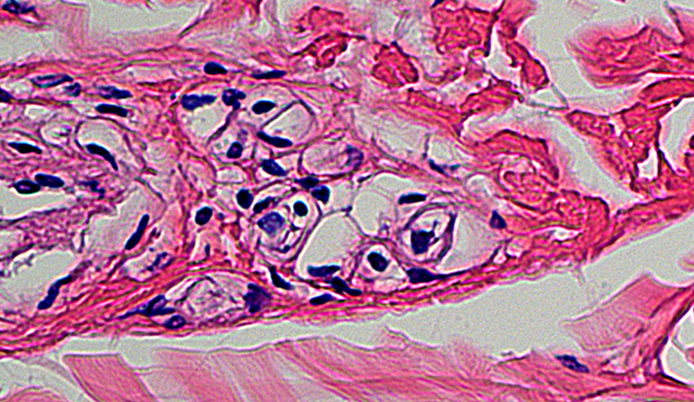 <p>What tissue is shown</p>