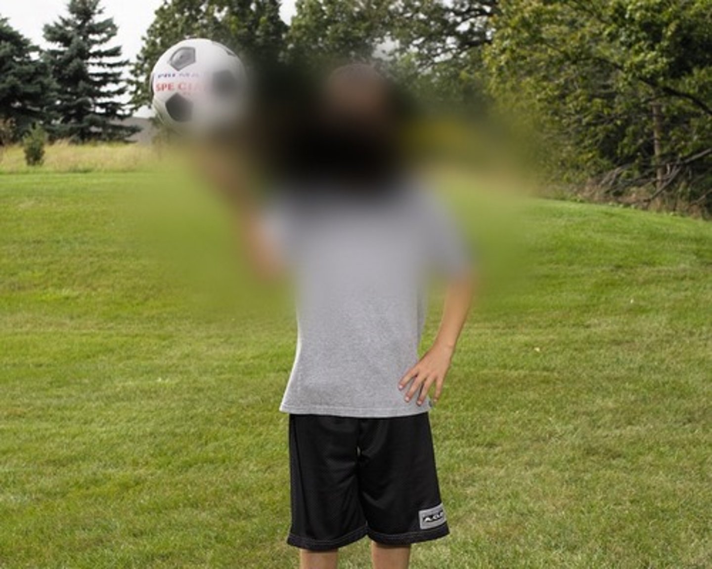 <p>deterioration of the macula of the retina, which corresponds to the focal center of the visual field</p>