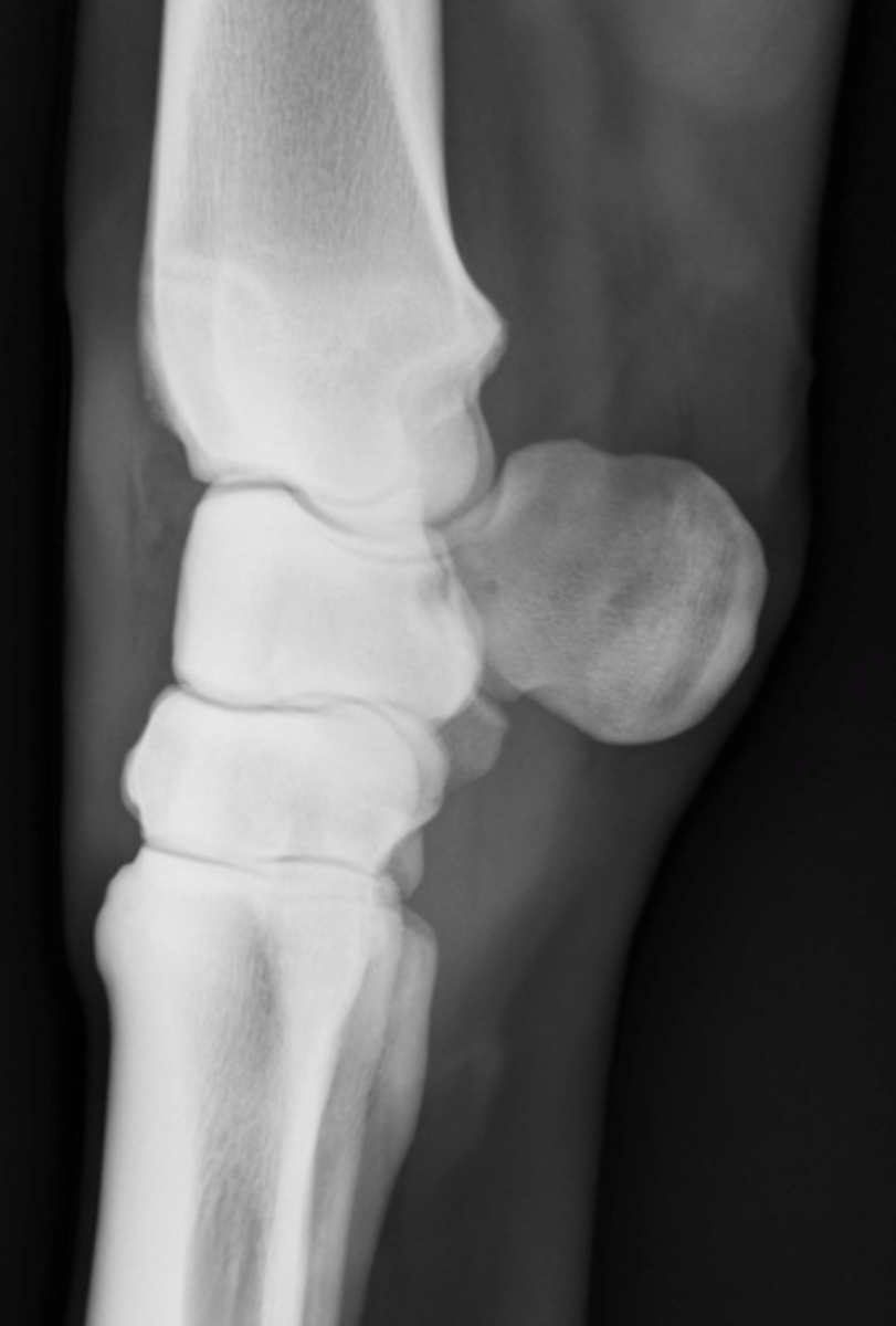<p>What is highlighted in a lateromedial view of the carpus?</p>