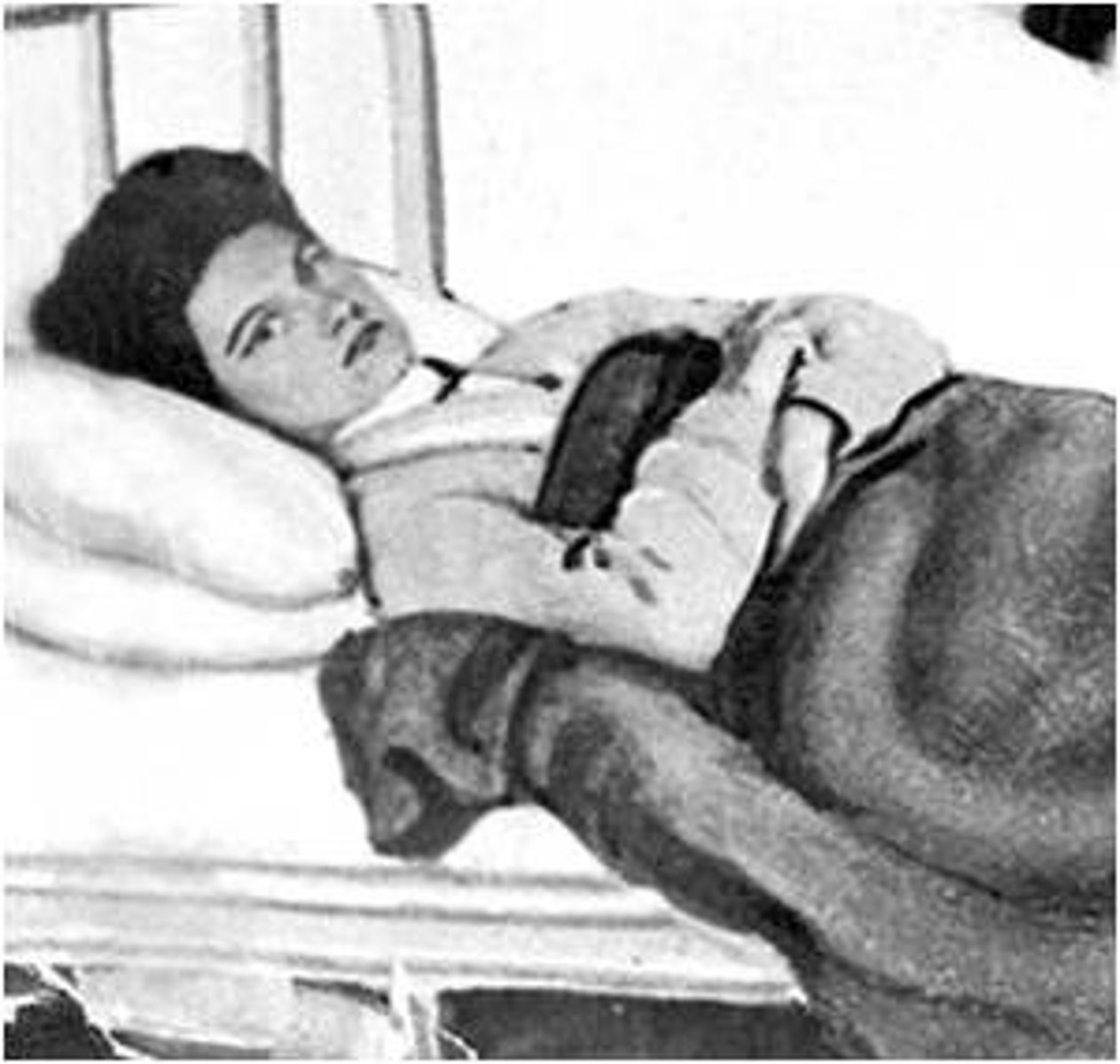 <p>A bacterial infection that spreads through contaminated water and food. It causes problems with organs and, if untreated, organ failure, and death.</p>