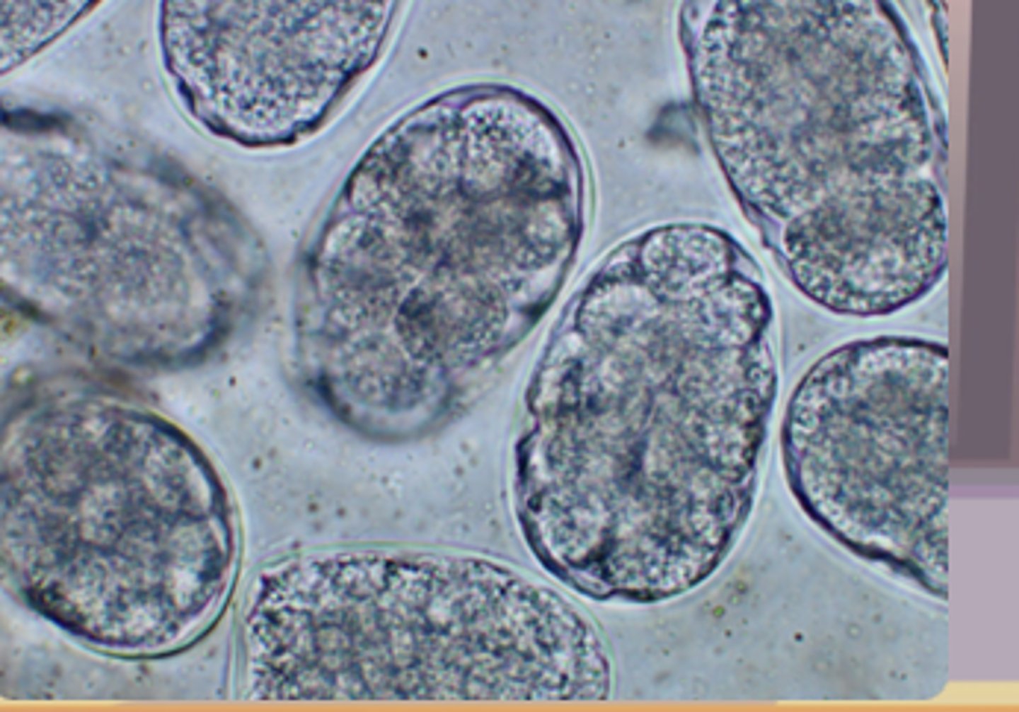 <p>Ancylostoma caninum</p><p>3 multiple choice options</p>