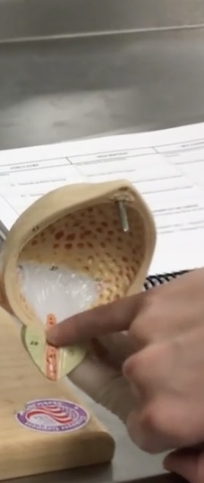 <p>Description: Space at the apex of the trigone</p><p>Relationship: Where urine exits the urinary bladder</p>