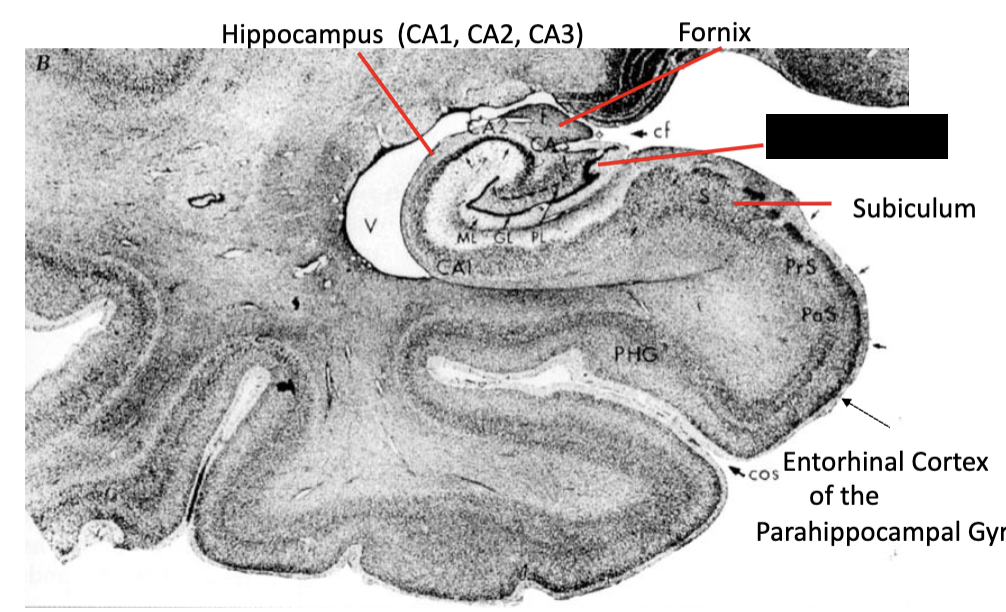 <p><strong>limbic system</strong></p><ul><li><p>what structure is this?</p></li></ul><p></p>