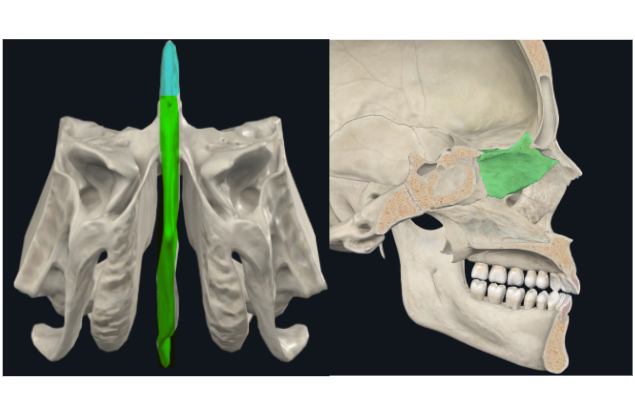 <p></p><ul><li><p>Lámina perpendicular del etmoides</p><ul><li><p>Forma parte del tabique de separación de ambas fosas nasales (septum/tabique nasal)</p></li></ul></li><li><p>Apófisis crista galli por arriba de la lámina horizontal</p></li></ul><p></p>