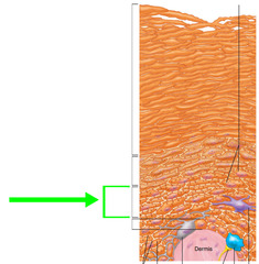 "Prickly layer" made of layers of cuboidal cells. Contains lots of desmosomes and pro keratin.