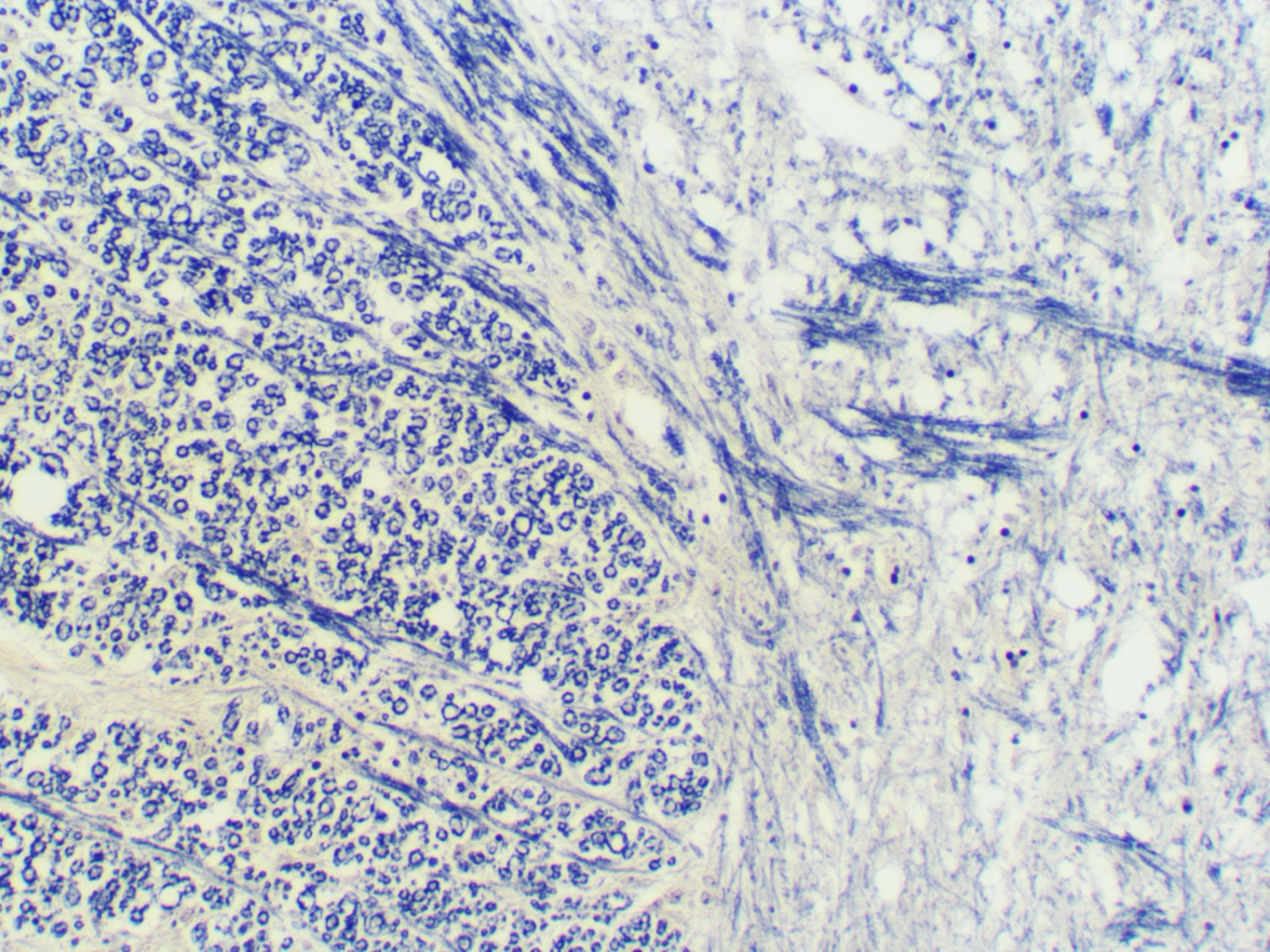 term image