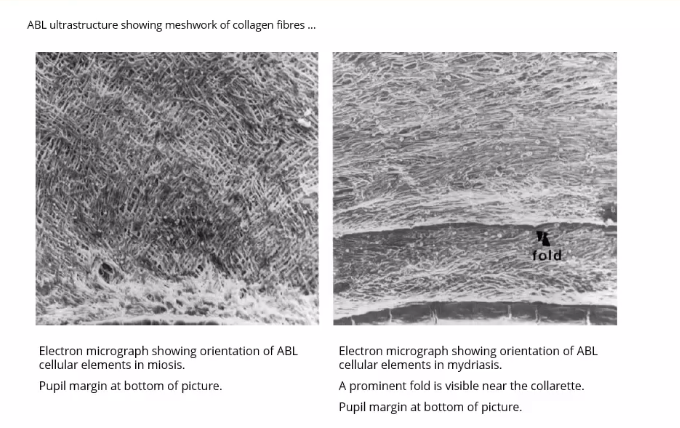 <p>where is anterior border of the iris absent at </p>