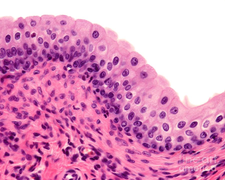 <p>What type of epithelium is indicated by the green arrow?</p>