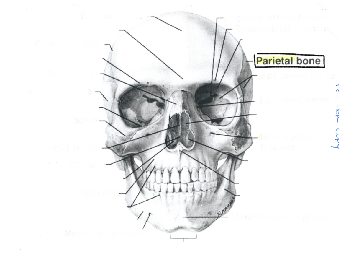 <p>Parietal bone</p>