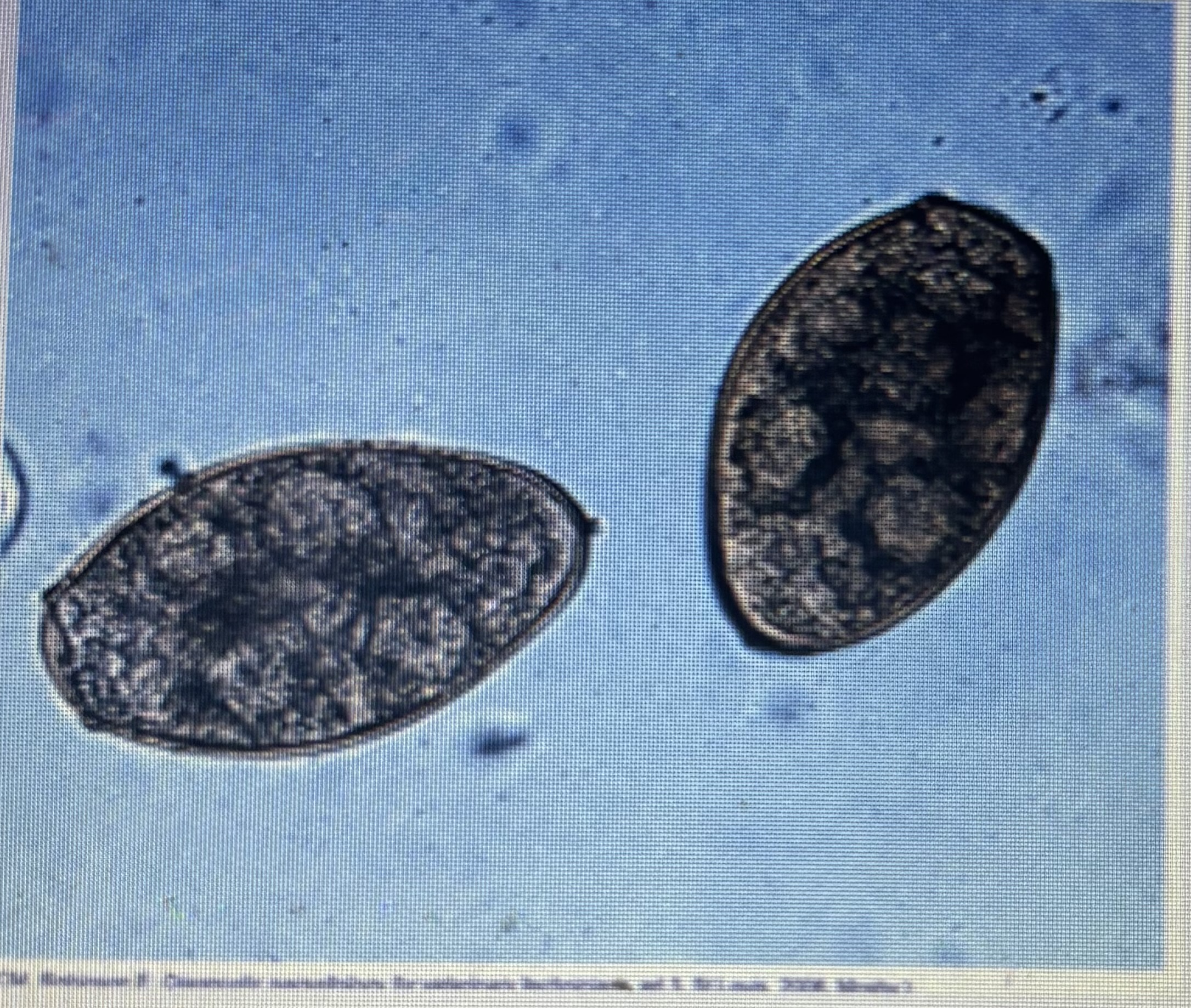 <p>Lung fluke </p><p>Host species - dog/cats</p><p>Size - 75-118um x 42-67 um Prepatent</p><p>Prepatent period - 30-36 days </p><p>Transmission - ingestion of infected raw crayfish or crab </p>