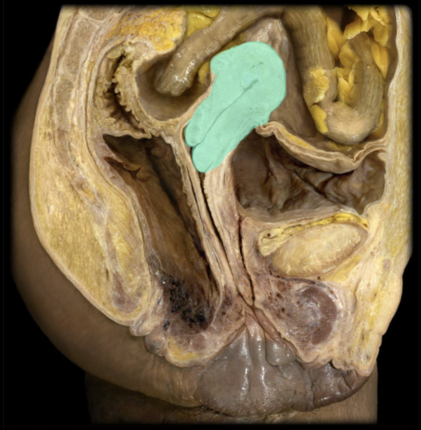 <p>What structure is shown?</p>