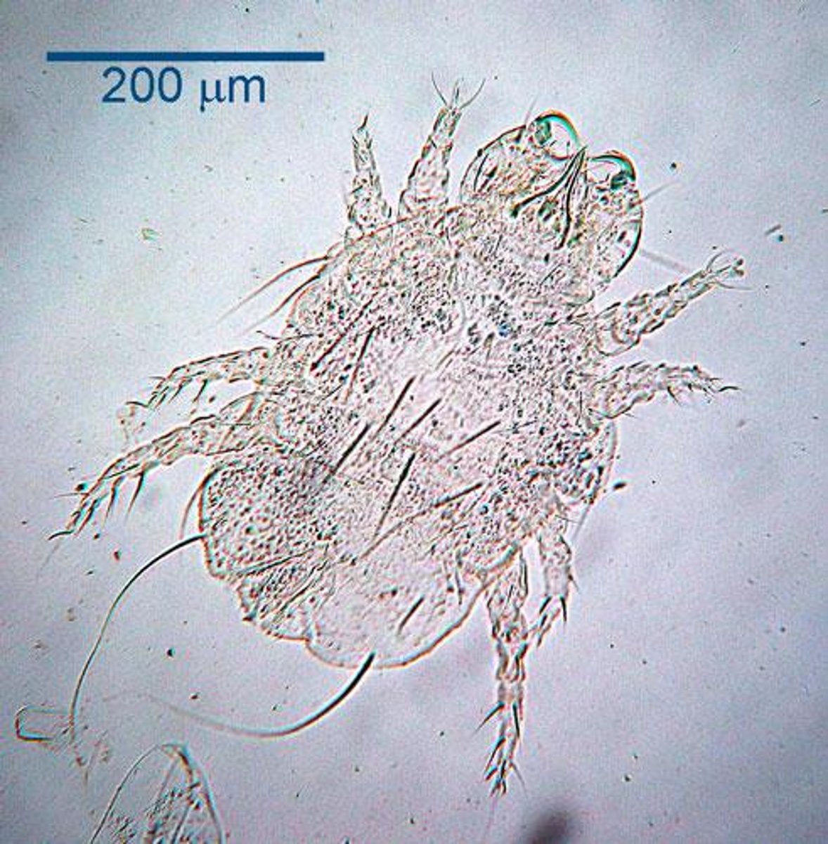 <p>This critter came off of a 10-year-old terrier with flaky dermatitis. What are they?</p>