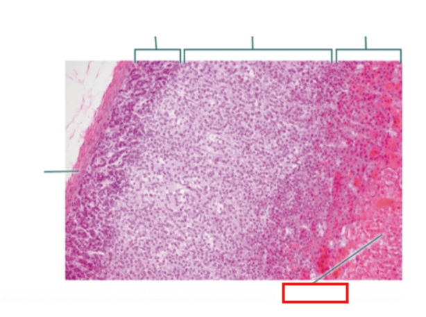 <p>What structure is highlighted?</p>